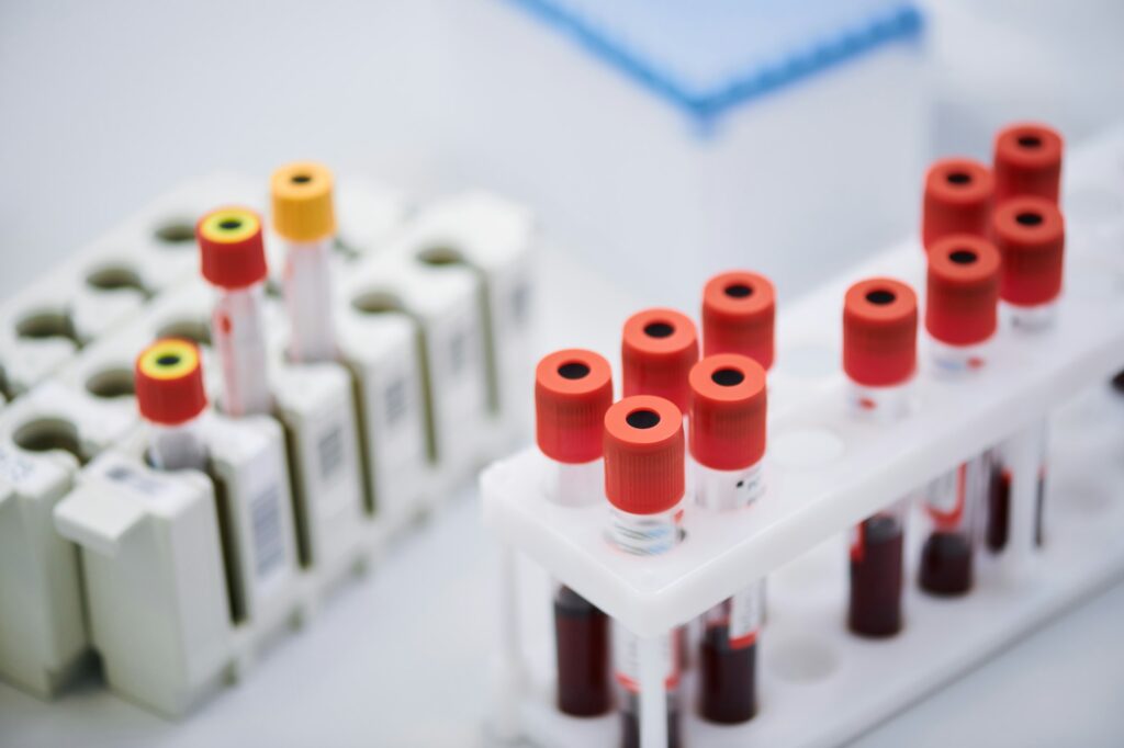 Blood test tube rack